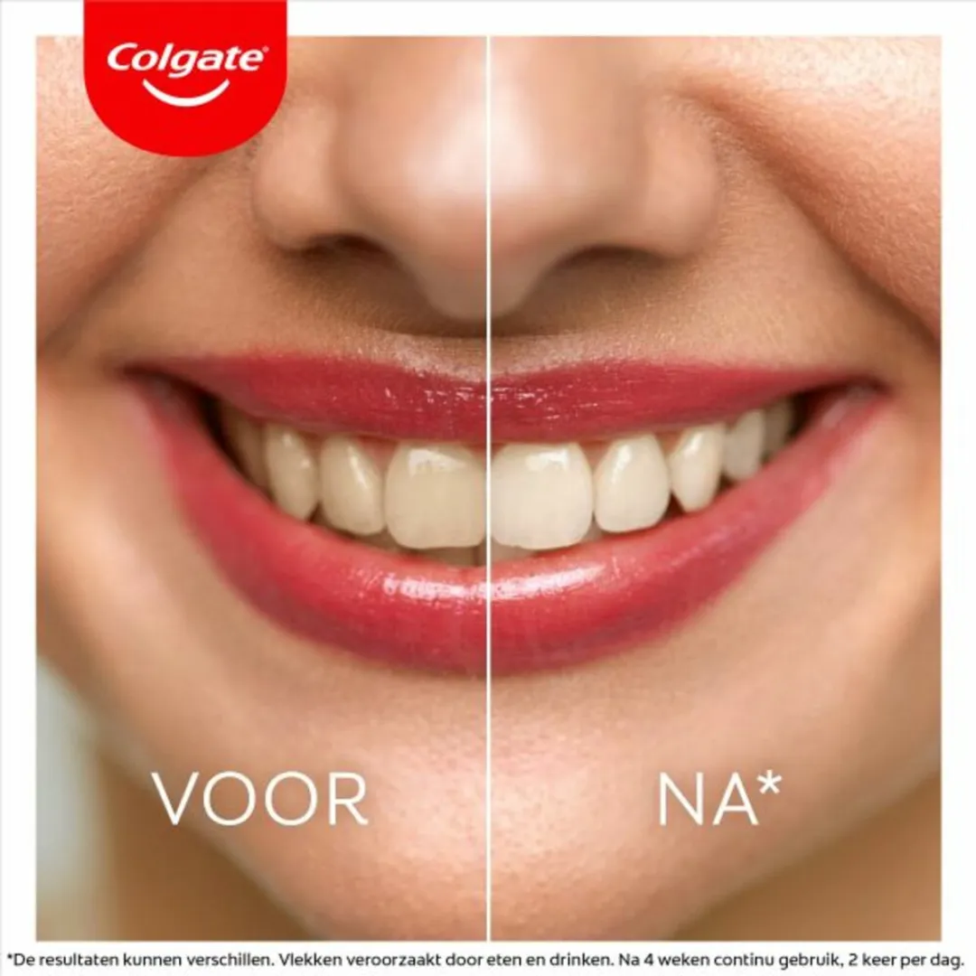 Colgate Max White Ultra Freshness Pearls Tandpasta - 225ml (3x75ml)