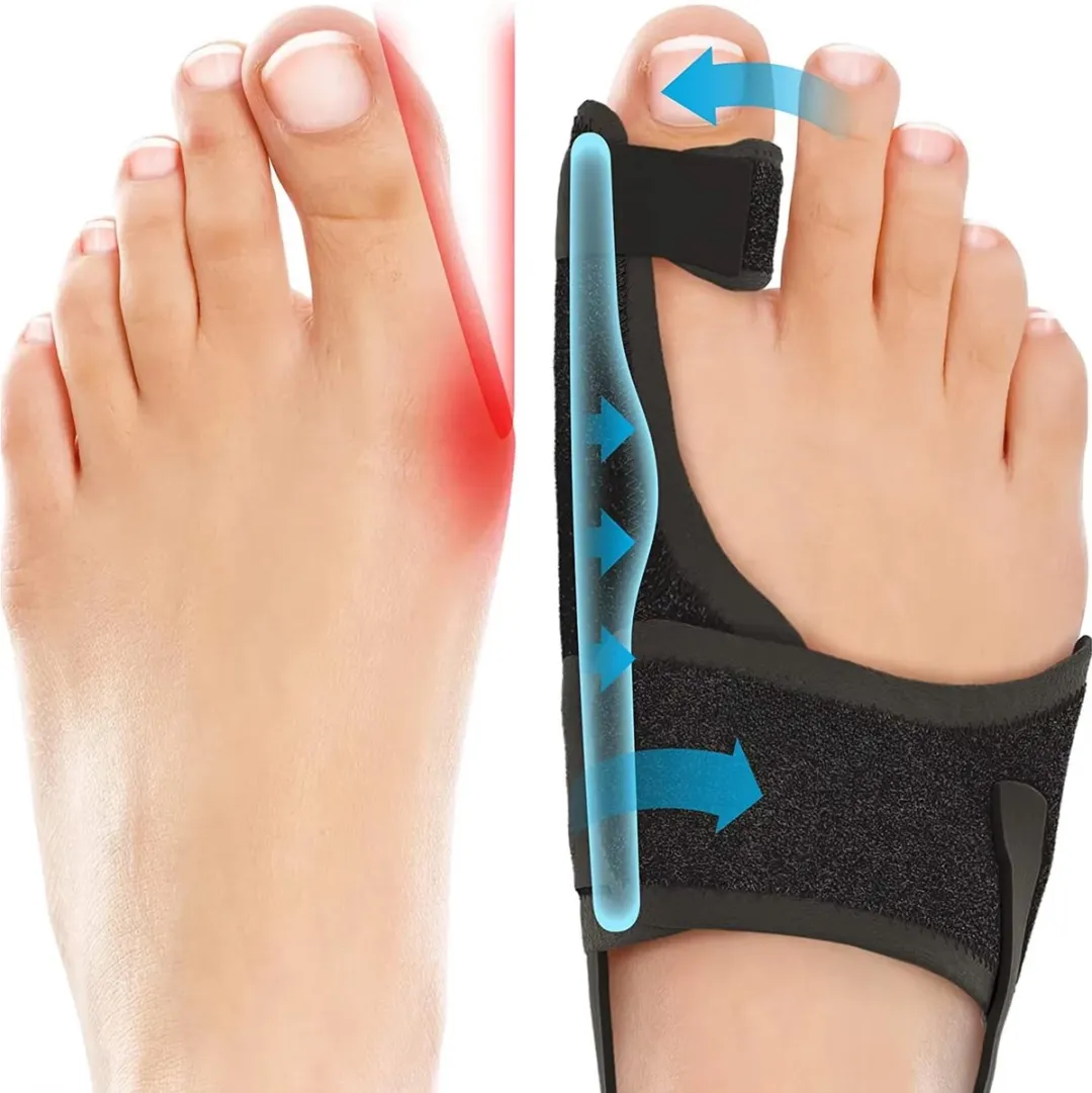 RedParrot Hallux Valgus Corrector Rechtervoet - Rechts - Zwart