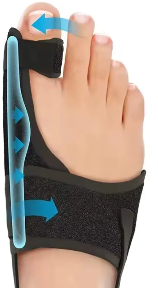 RedParrot Hallux Valgus Corrector Rechtervoet - Rechts - Zwart