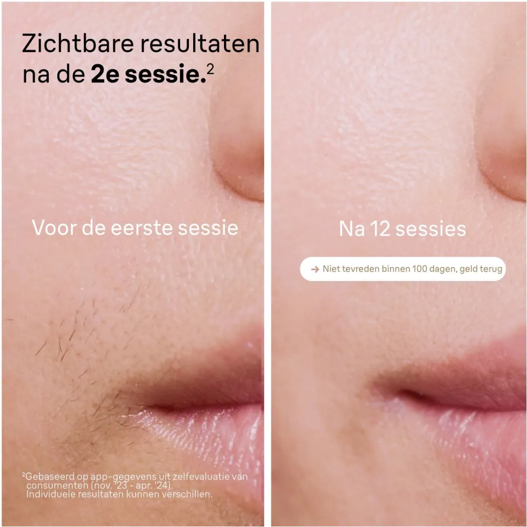 Braun IPL Silk-expert Pro 5 PL5242 Ontharingsapparaat - 400.000 Flitsen - Wit