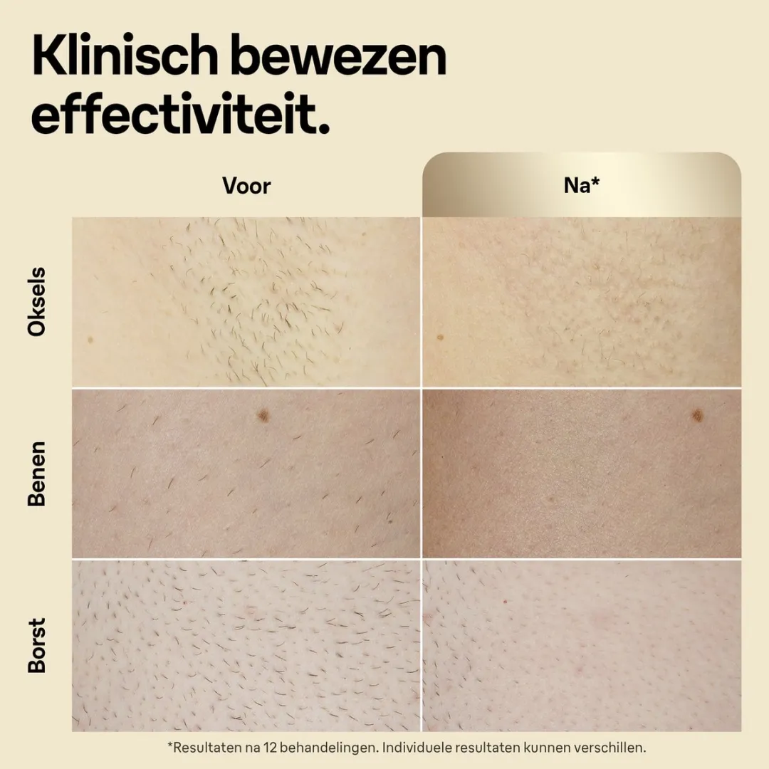 Braun Silk-expert Pro 5 PL5140 IPL Ontharingsapparaat - 400.000 Flitsen - Wit