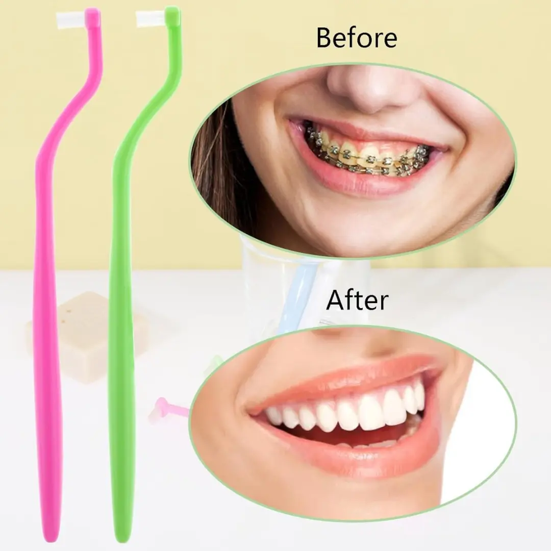 ECTEATOY Orthodontische Tandenborstel 4 Stuks - Blauw+Groen