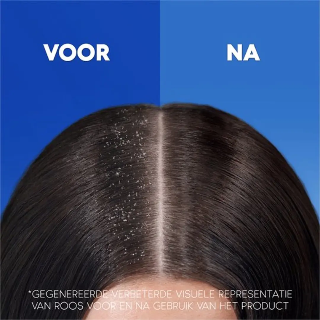 Head & Shoulders Jeukende Hoofdhuid Anti-Roos Shampoo 2-in-1 - 6x330ml