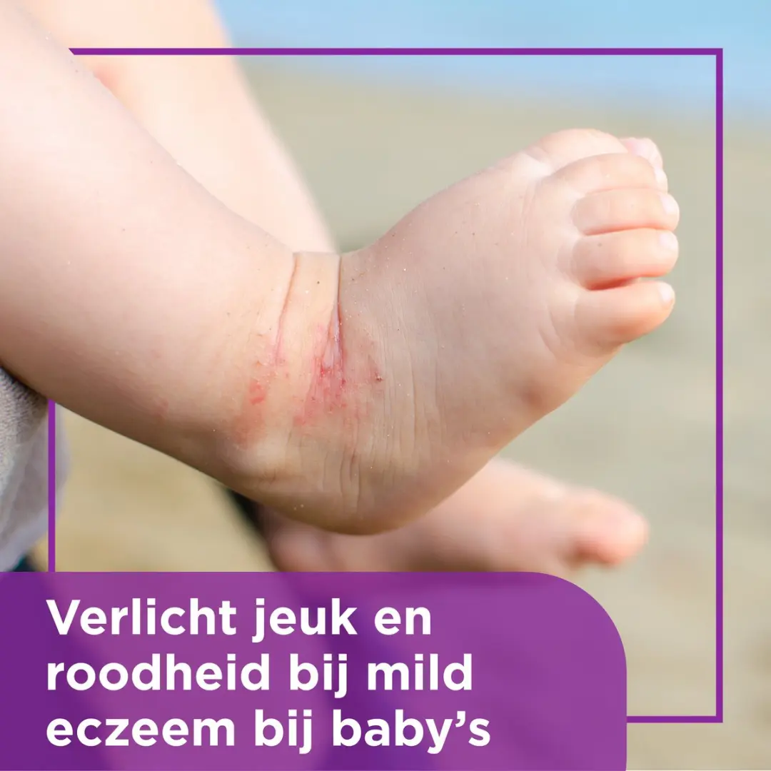 Bepanthen Eczeem Crème 20g