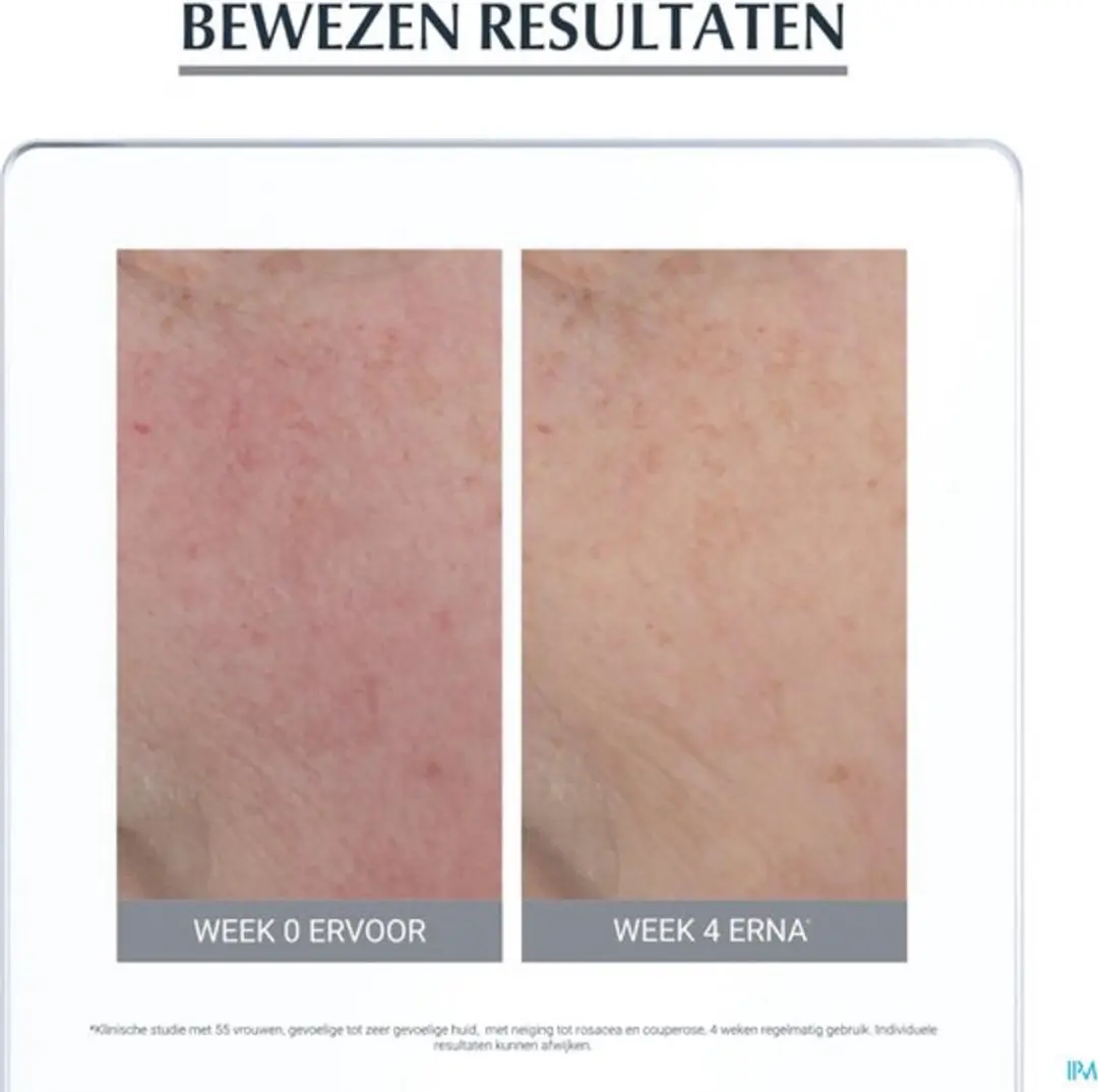 Eucerin AntiREDNESS Corrigerende Crème 50ml - 2 Stuks