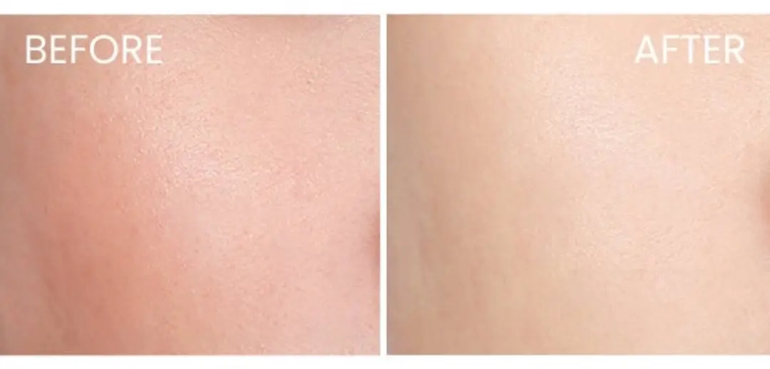 Shiseido Expert Sun Zonnebrandcrème SPF 30 - 150ml