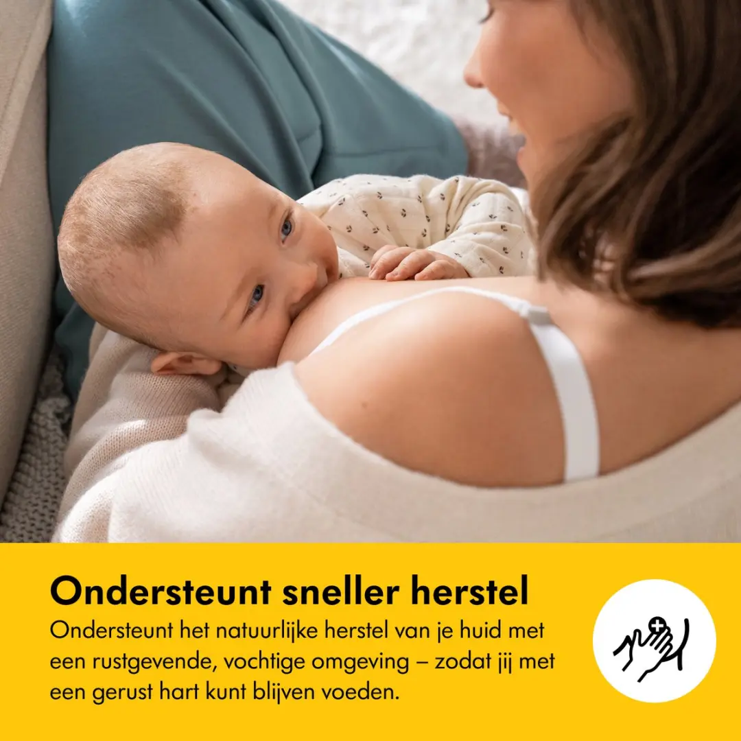 Medela Hydrogel Pads - 4 Stuks