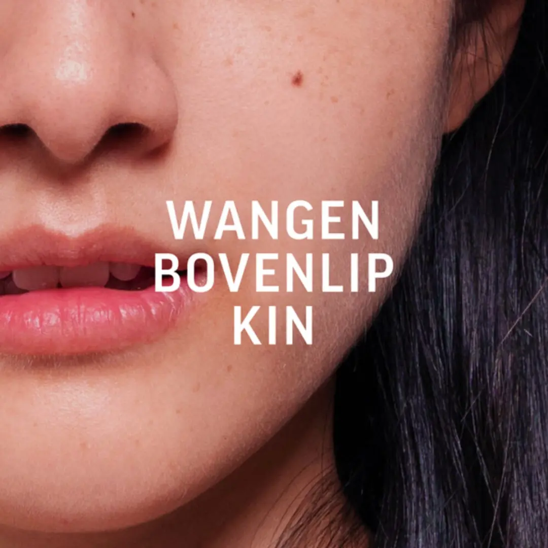 Veet Ontharingsstrips Gezicht Hypoallergene Minima - 20 Stuks