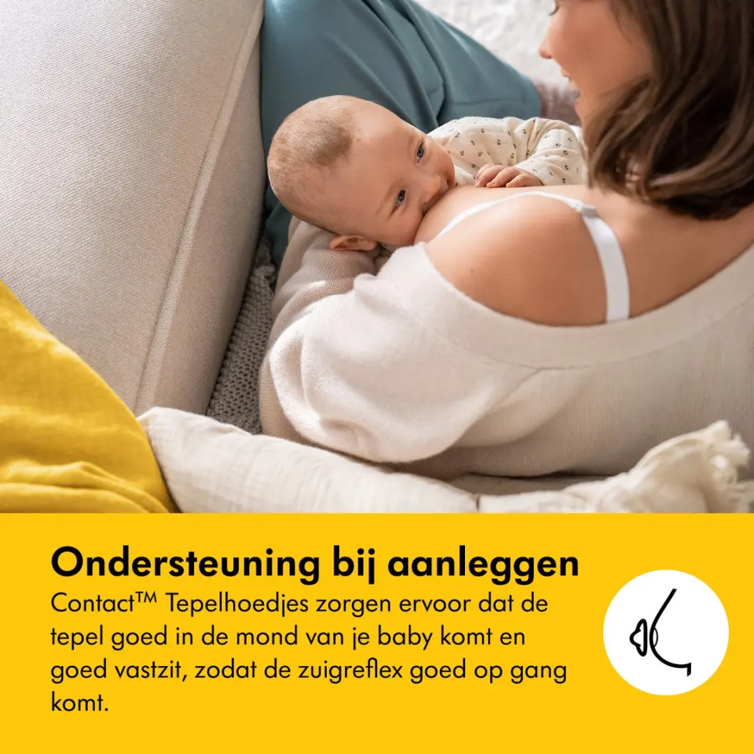 Medela Contact Tepelhoedjes M - 20mm - 2 Stuks - Geel