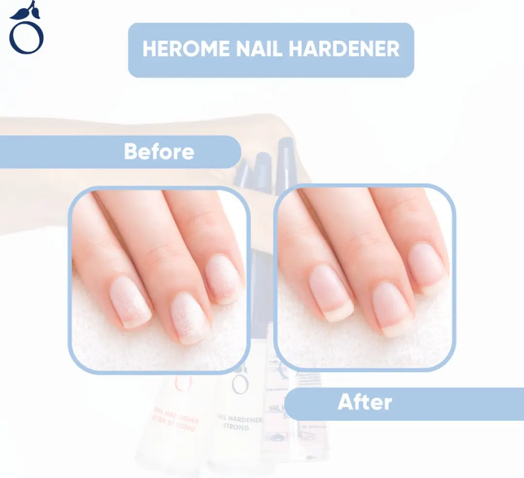 Herome Nagelverharder Sterk 10ml - 4 Stuks