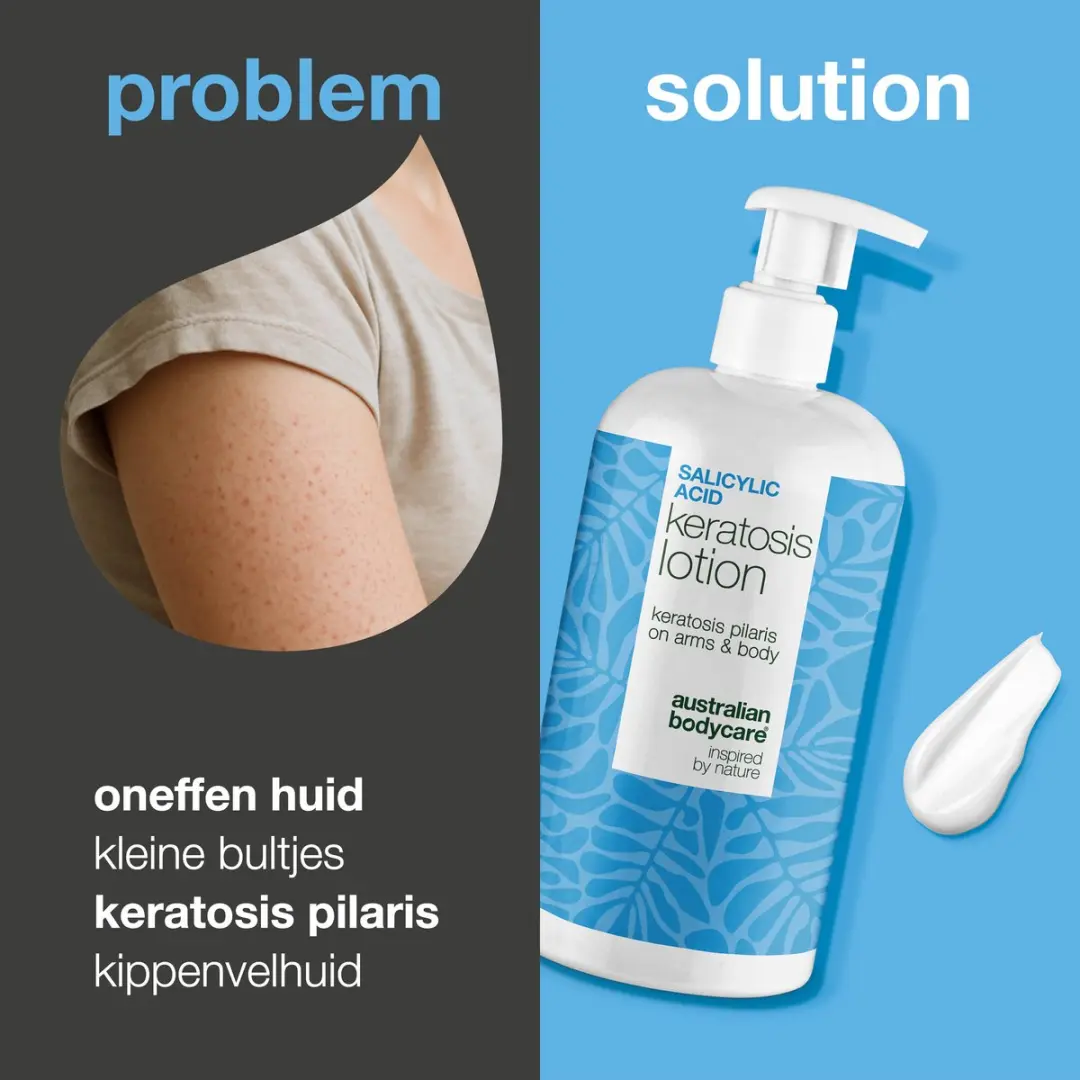 Australian Bodycare Bodylotion Keratosis Pilaris 500ml