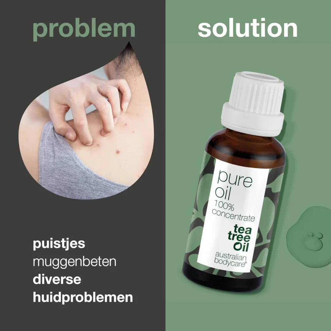 Australian Bodycare Pure Tea Tree Olie 30ml