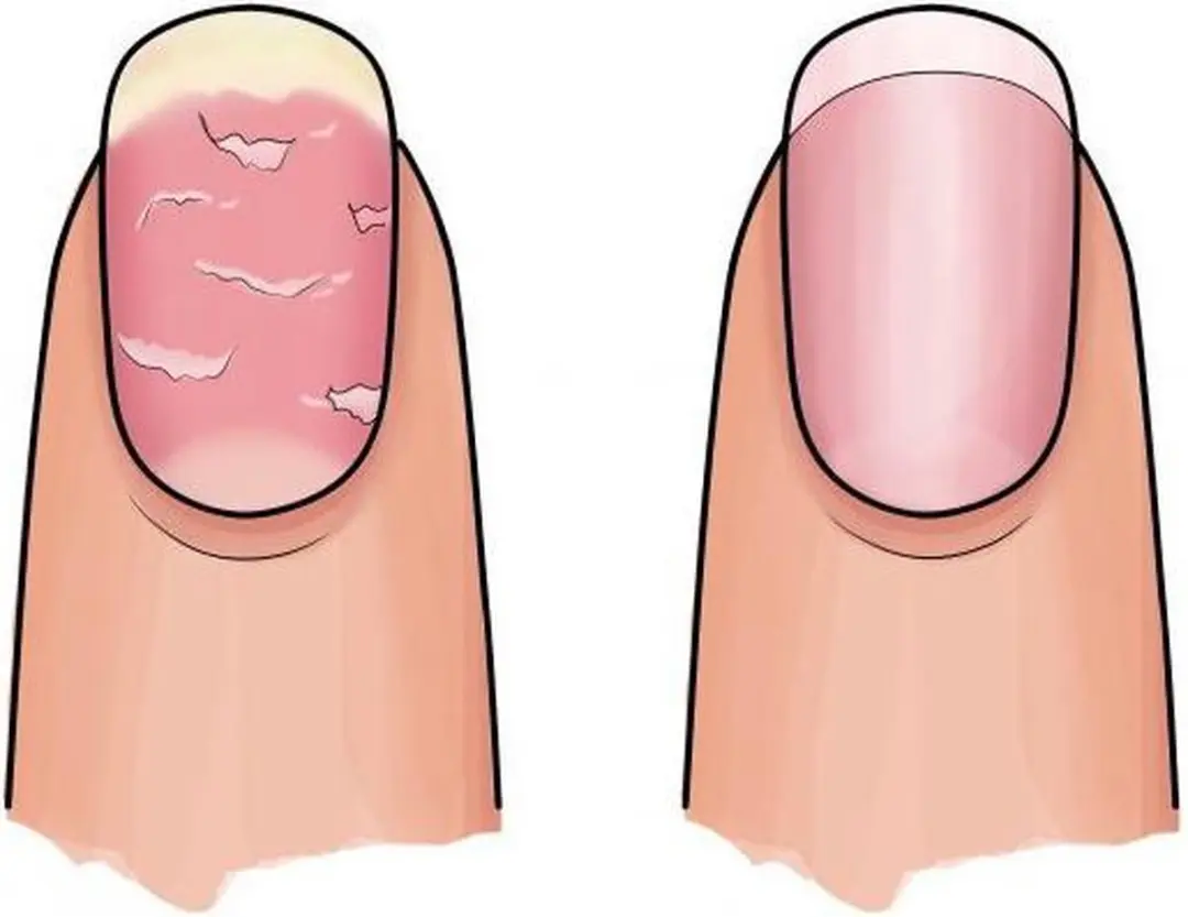 Herome 3-in-1 Nagelverzorgingsset - 84g