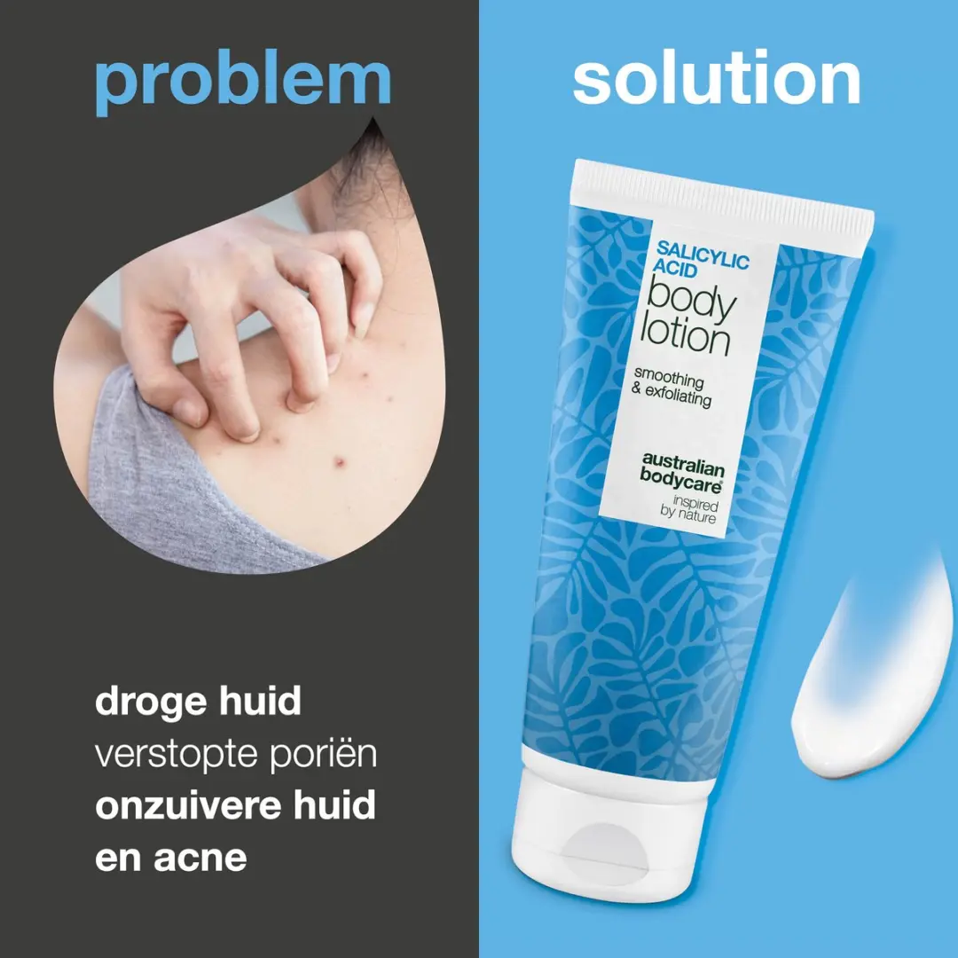 Australian Bodycare Body Lotion 200ml - Salicylzuur