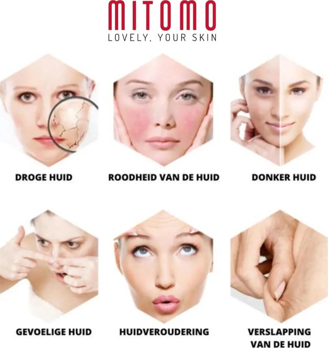 Mitomo Japan Hyaluron & Lithospermum Gezichtsmaskers - 8 Stuks