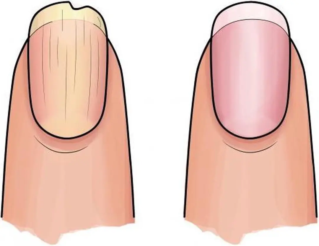 Herome Nail Essentials Set Geel - 3-in-1 Manicure