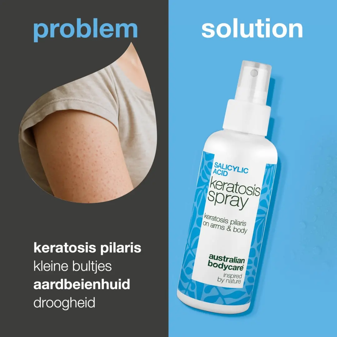 Australian Bodycare Keratosis Pilaris Spray 100ml