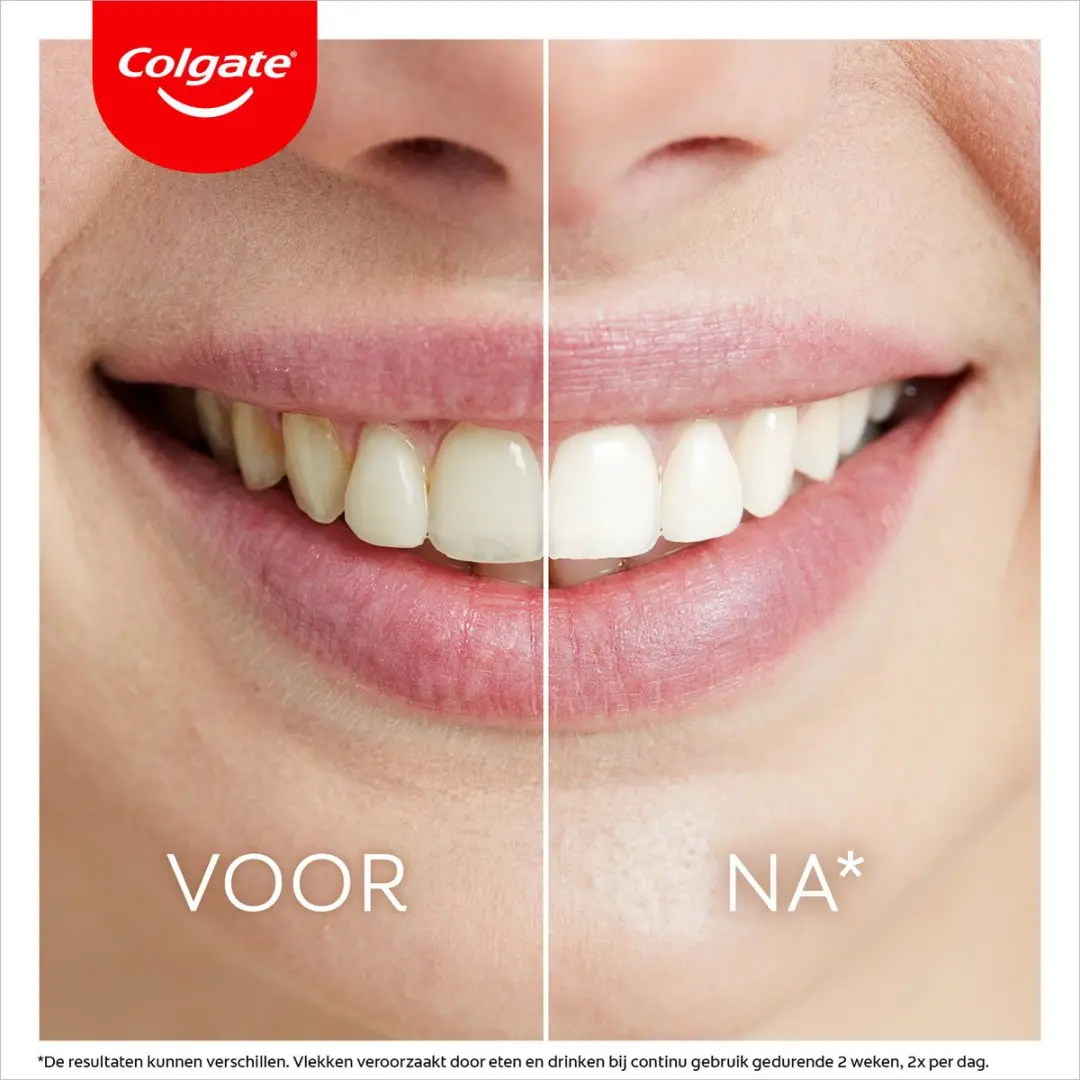 Colgate Max White Led Whitening Kit 2 Stuks - MPN 4619037 - afbeelding 6 van 6
