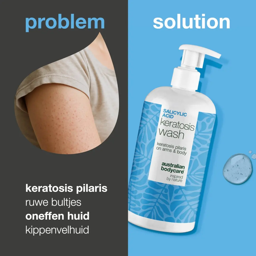 Australian Bodycare Keratosis Pilaris Douchegel 500ml