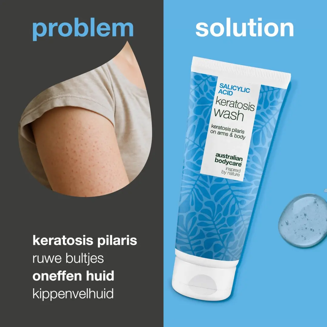Australian Bodycare Keratosis Pilaris Douchegel 500ml
