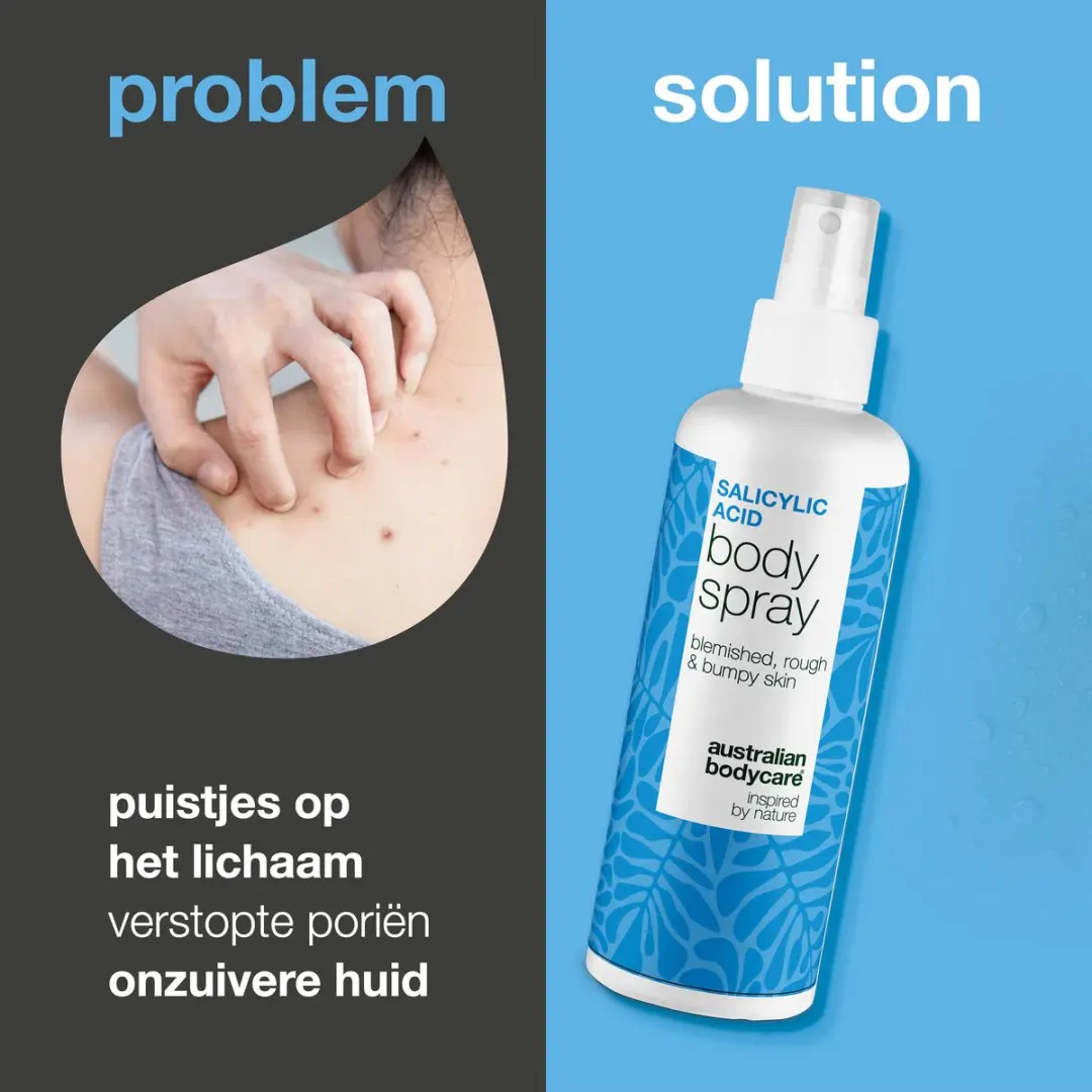 Australian Bodycare Salicylzuur Spray 100ml