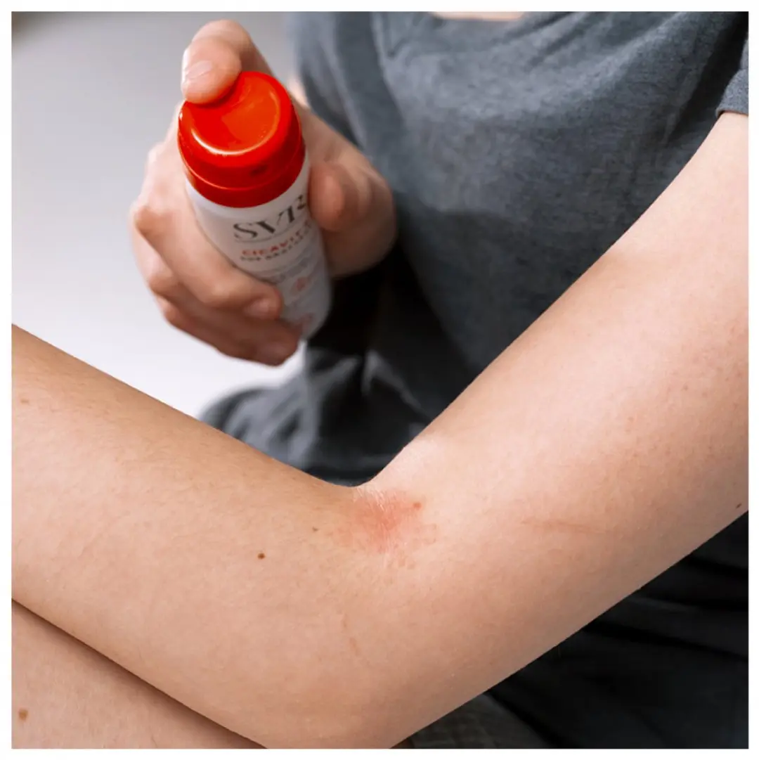SVR SOS Grattage Lichaamscrème 40ml - 40 Stuks