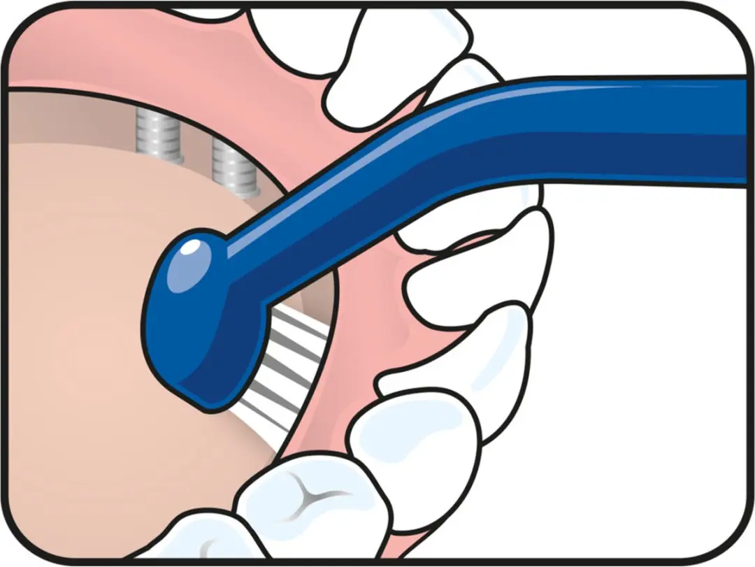 TePe Universal Care Tandenborstels - 3 Stuks - Blauw