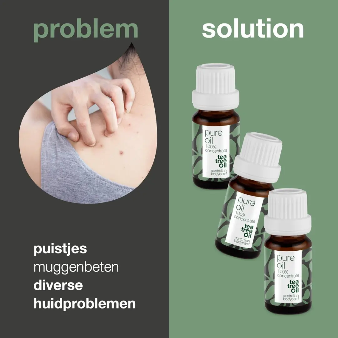 Australian Bodycare Pure Tea Tree Olie 3x30ml - 90ml - afbeelding 6 van 6
