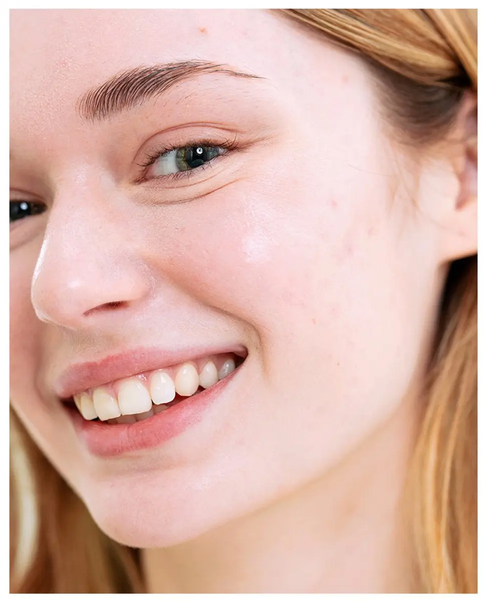SVR Sebiaclear Anti-Imperfecties Zonnebrandcrème 40ml - 40 Stuks