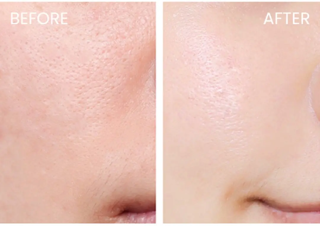 Kiehl's Clearly Corrective Dark Spot Solution 115ml