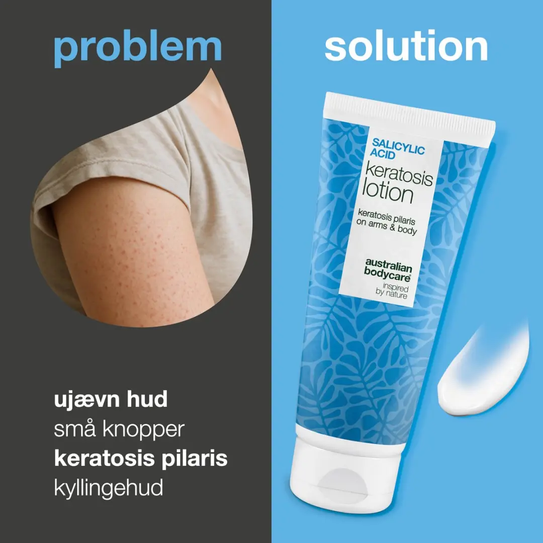 Australian Bodycare Body Lotion Keratosis Pilaris 200ml