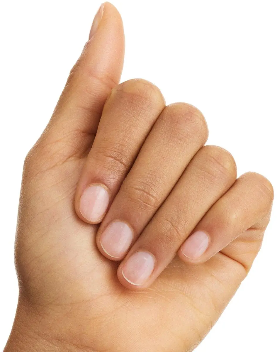 Essence Nagelherstel Versterkende Behandeling 8ml