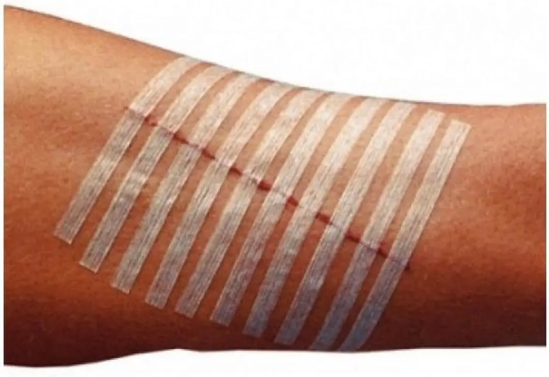 3M Steristrips Pleisters 10 Stuks - Paars