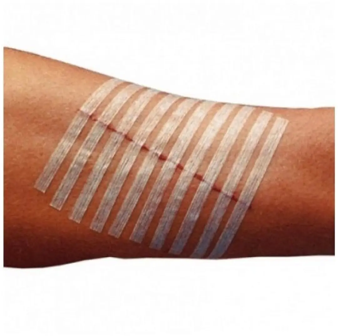 3M Steristrip Hechtstrips 38mm - 20 Stuks