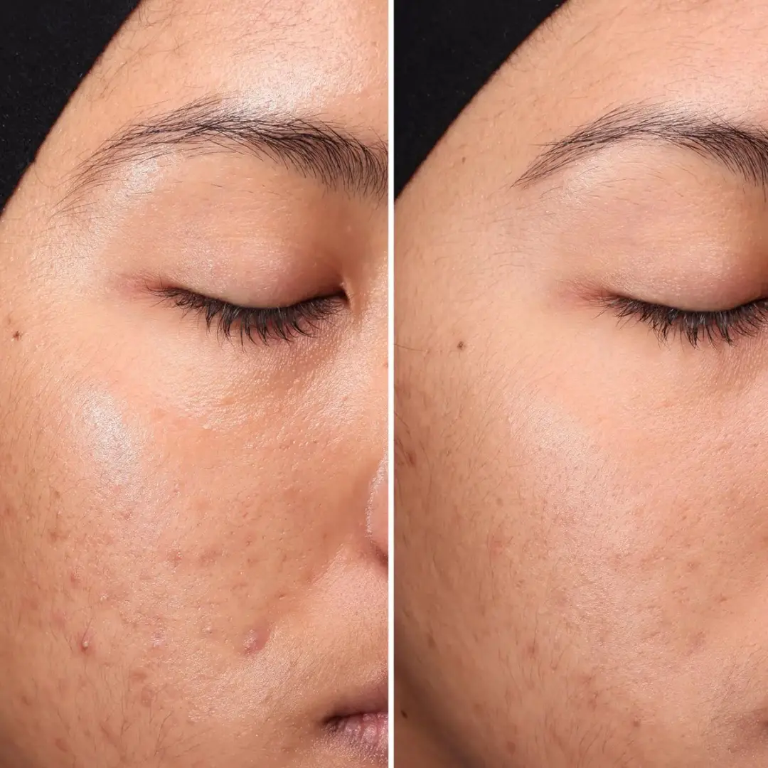 Medik8 Press & Clear Cleanser 150ml