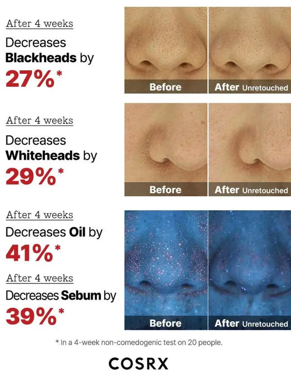 CosRx The AHA 2 BHA 2 Blemish Treatment 120g