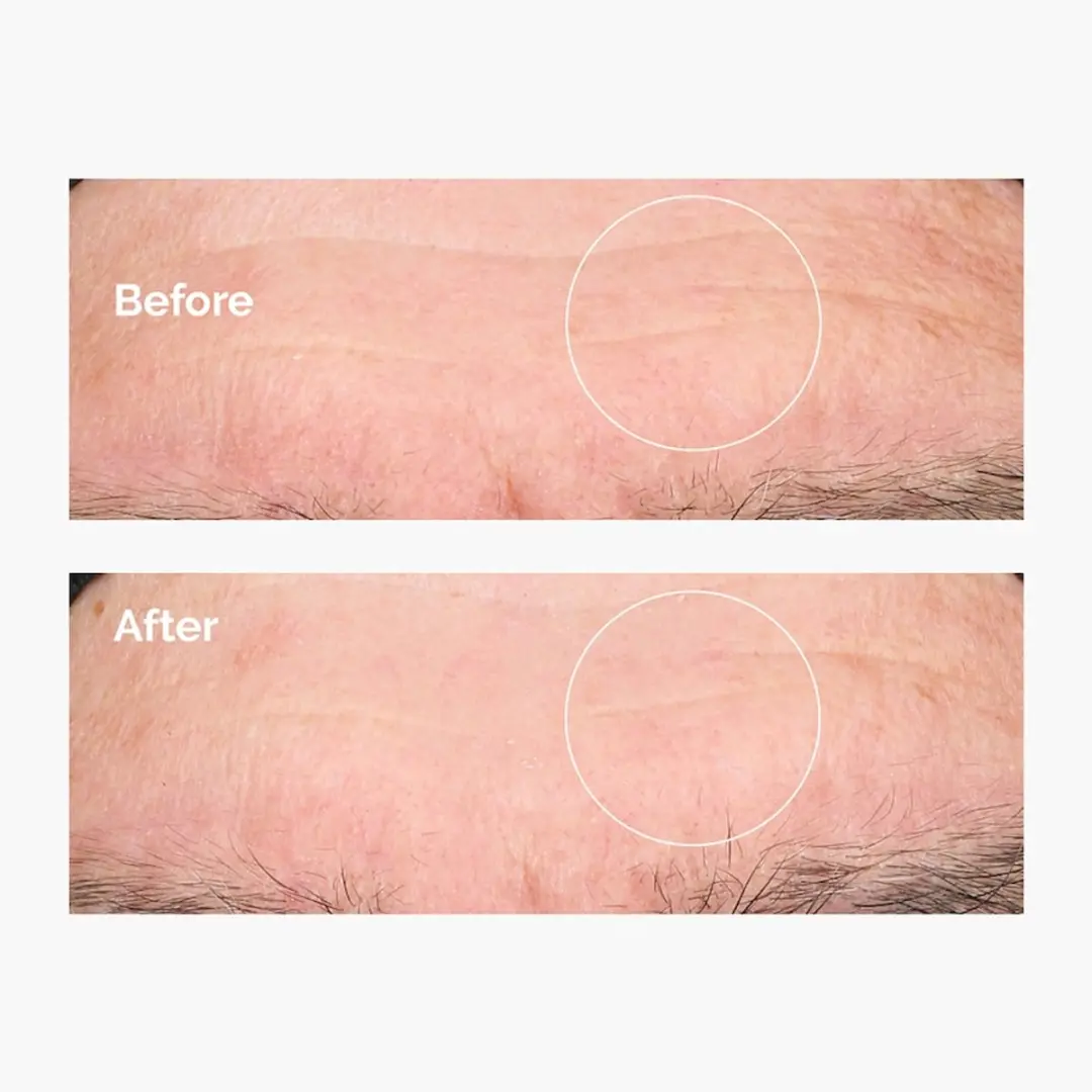 The Ordinary Hyaluronic Acid 2% + B5 + Ceramides Serum 30ml