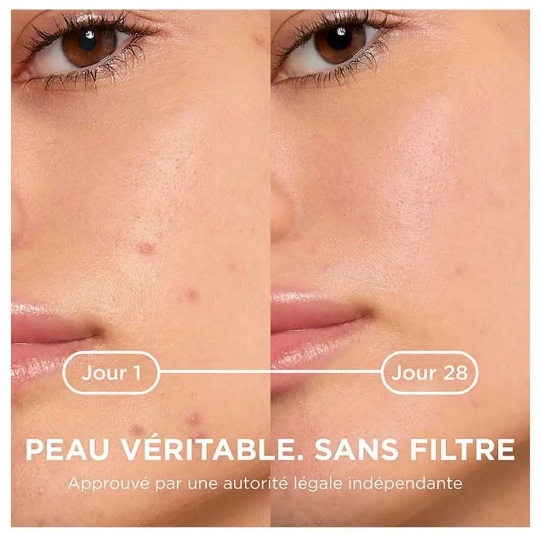 Bioderma Sébium Kerato+ Antiacné 30ml