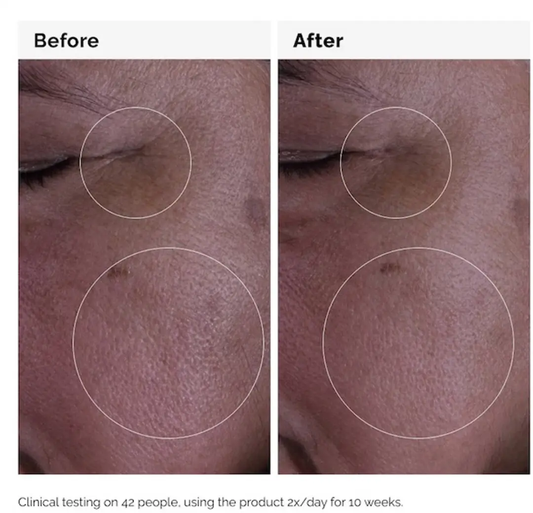 The Ordinary GF Solution 15% Serum - 30ml