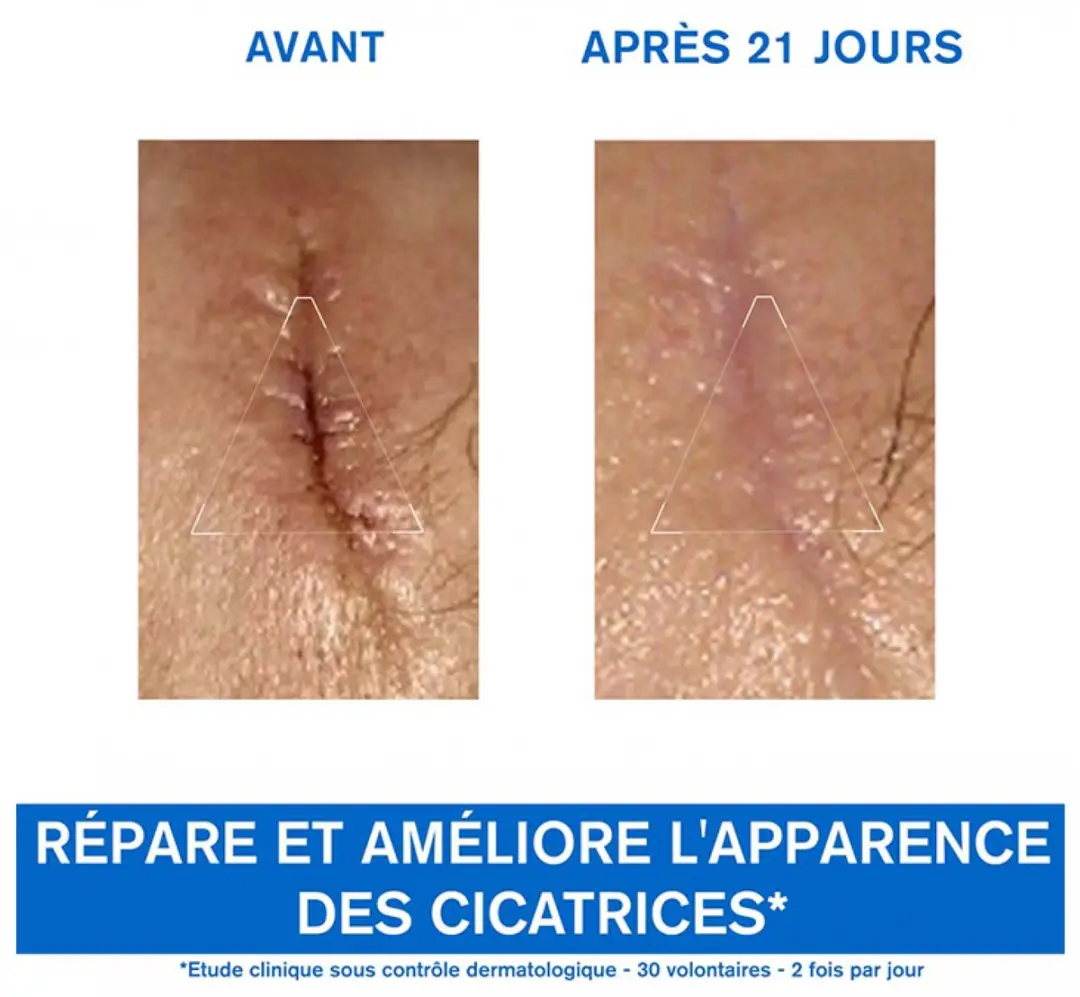 Uriage Bariéderm-CICA Gezichtscrème 40ml