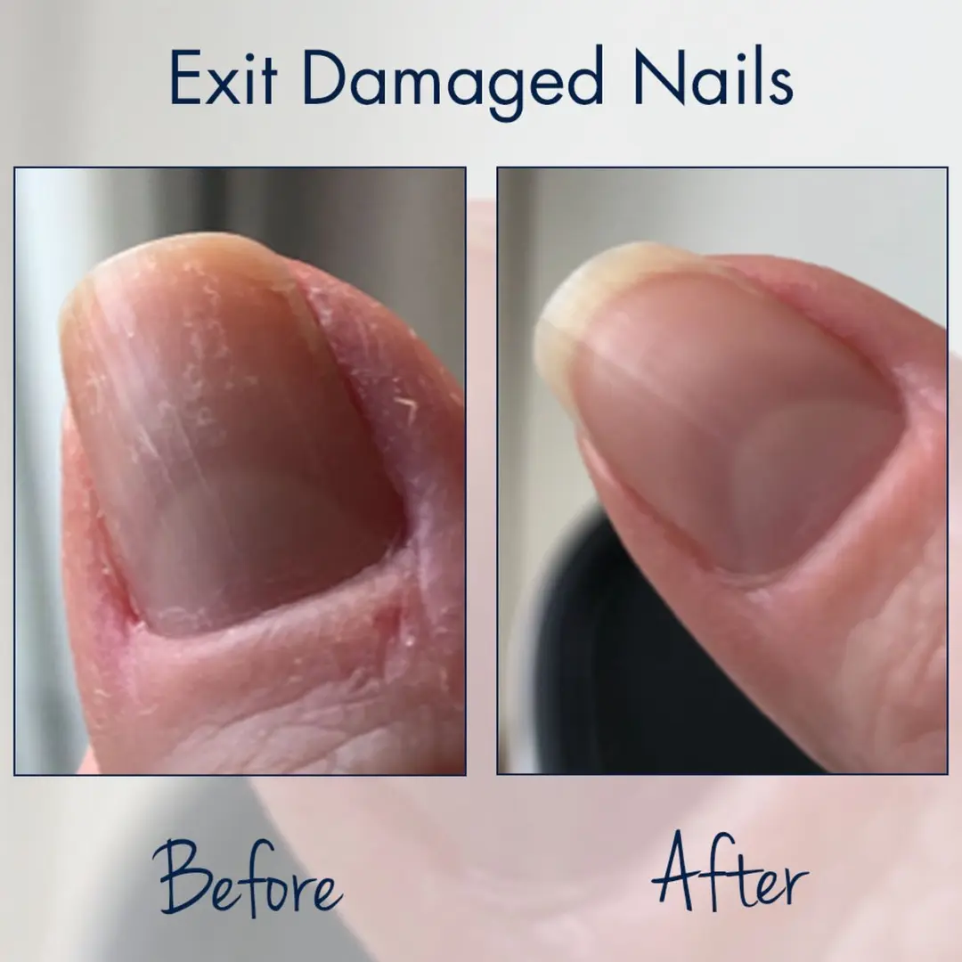 Herome Exit Damaged Nails Nagelolie & Nagelverharder - 17ml