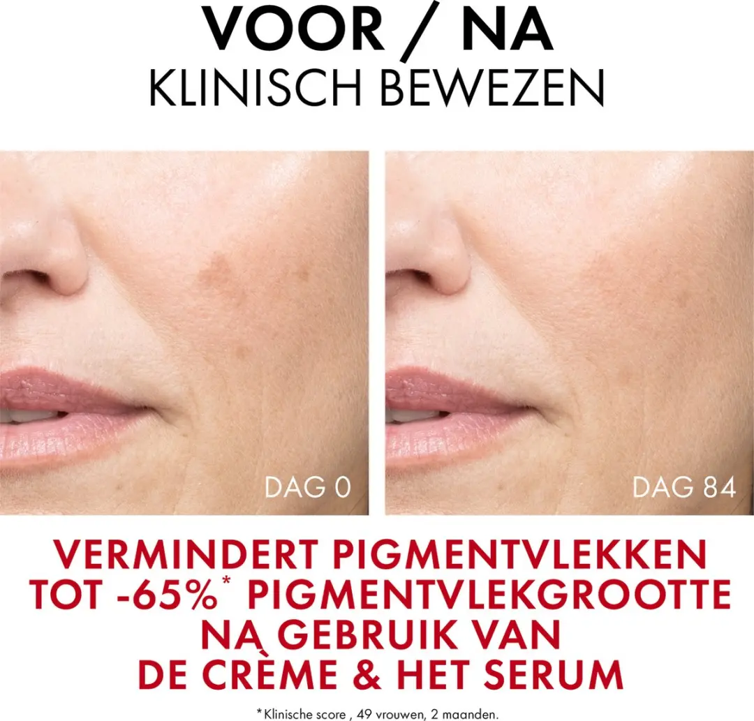VICHY Liftactiv Pigment Specialist B3 SPF50 - 50ml - afbeelding 6 van 6