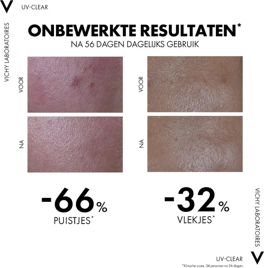 Vichy Capital Soleil UV Clear Gezicht Zonnebrand SPF50+ 40ml