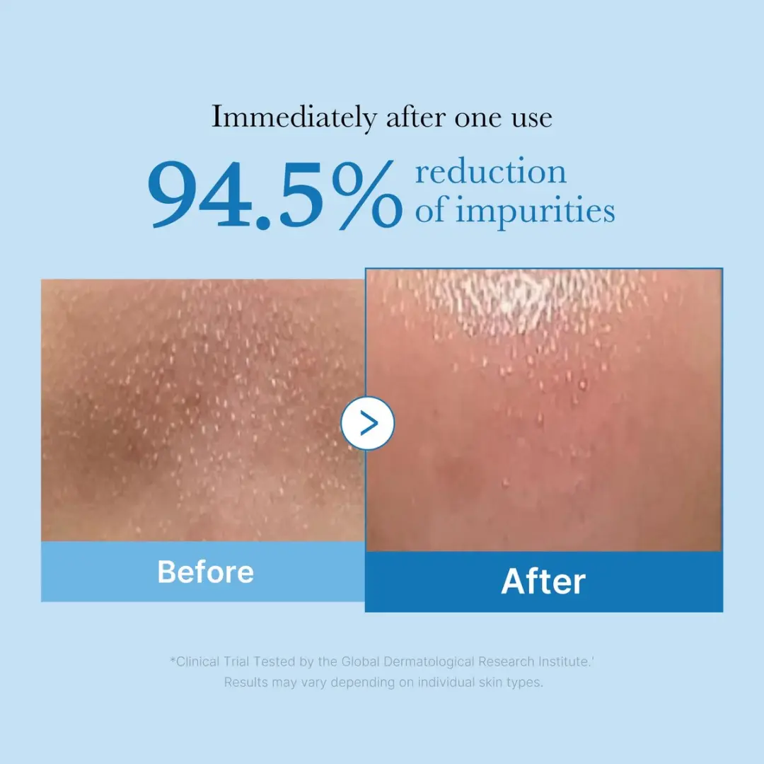 Medicube Zero Pore Blackhead Cleansing Oil 205ml