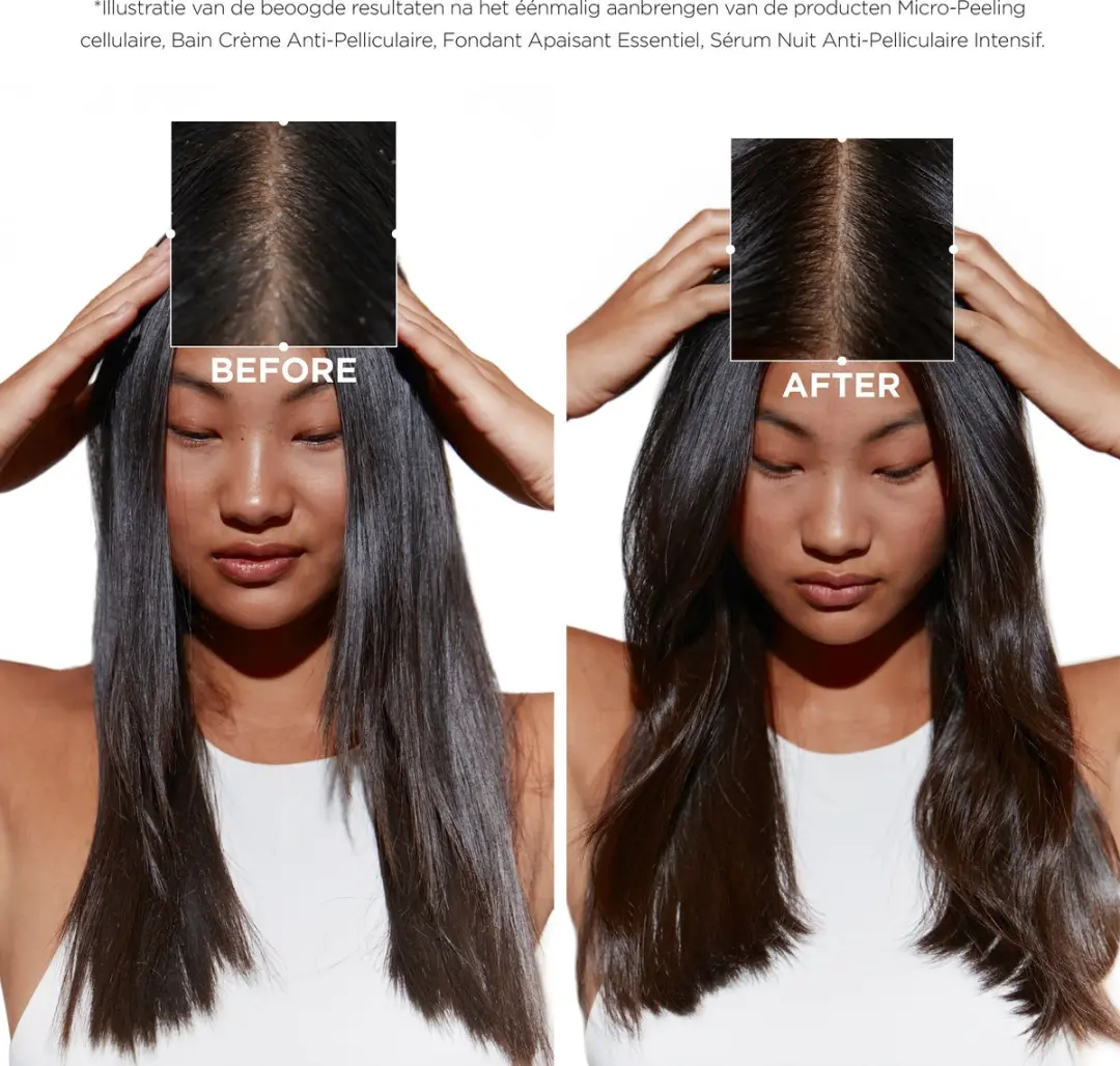 Kérastase Symbiose Anti-Roos Shampoo 250ml