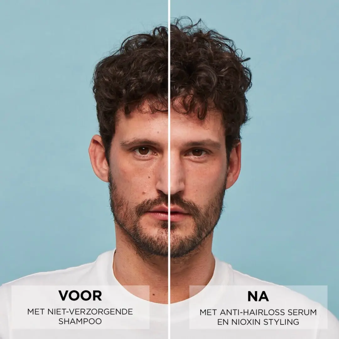 Nioxin Anti-Hairloss Serum 70ml