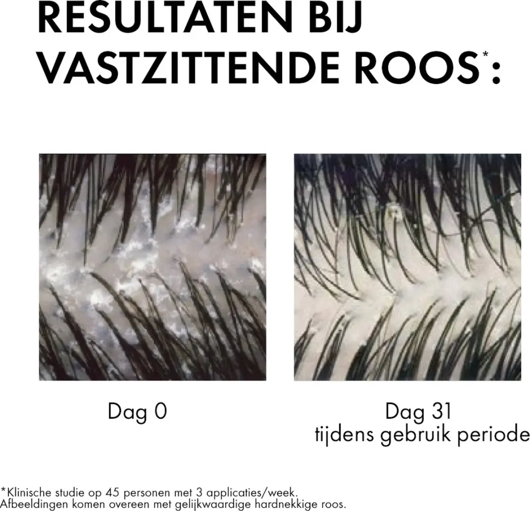 Vichy Dercos Technique Anti-Roos Shampoo 390ml - afbeelding 6 van 6