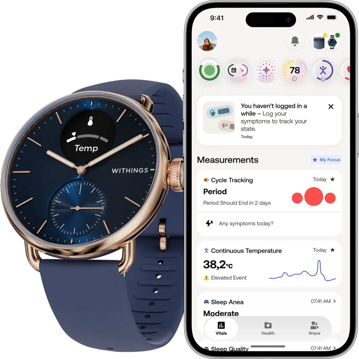 Withings ScanWatch 2 - 38mm - Hybride Smartwatch - Roségoud Blauw