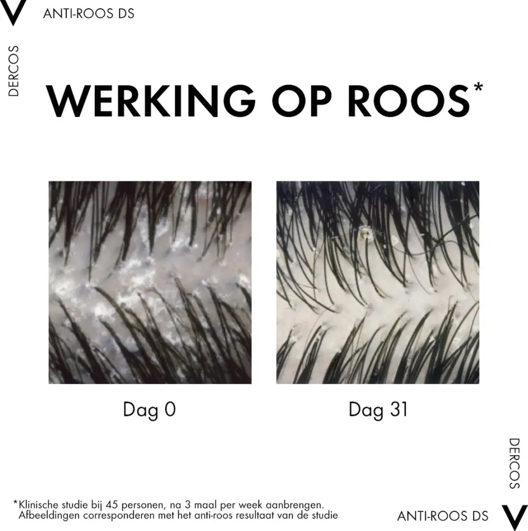 Vichy Dercos Anti-Roos Shampoo - 2x 390ml
