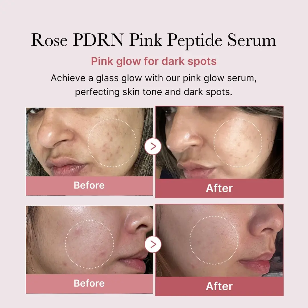 Medicube PDRN Pink One Day Serum 10x1.5ml